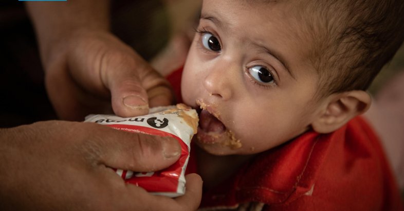 zdjęcie: 690 mln ludzi na świecie cierpi głód. Świat przegrywa walkę z niedożywieniem, alarmuje UNICEF, WFP, FAO, WHO i IFAD / fot. nadesłane / ©UNICEF/Suliman Alshargabi