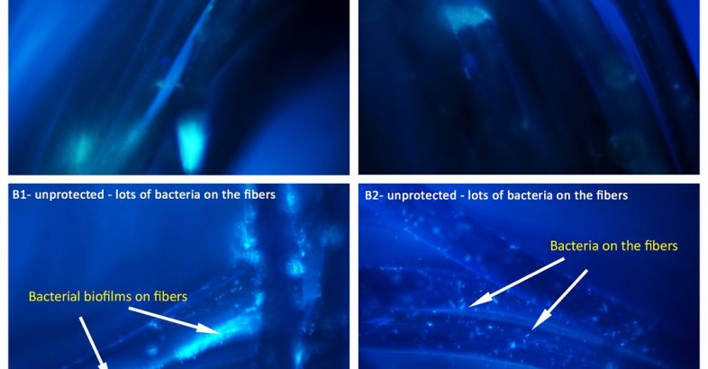 zdjęcie: Mechanizm biologiczny może pomóc zabezpieczać różne powierzchnie przed osadzaniem się na nich bakterii wodnych / fot. nadesłane