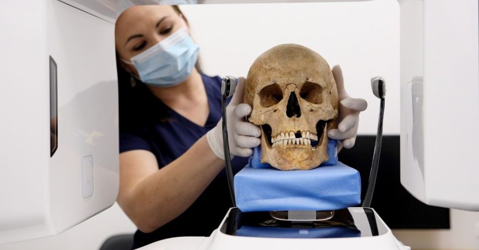 zdjęcie: Zęby ludzi średniowiecza – mniej próchnicy niż u współczesnych / fot. PAP
