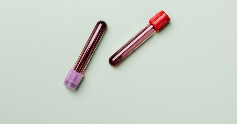 zdjęcie: Czerwone krwinki mają kształt podobny do sierpa, stąd nazwa tego rodzaju niedokrwistości / pexels/4047146