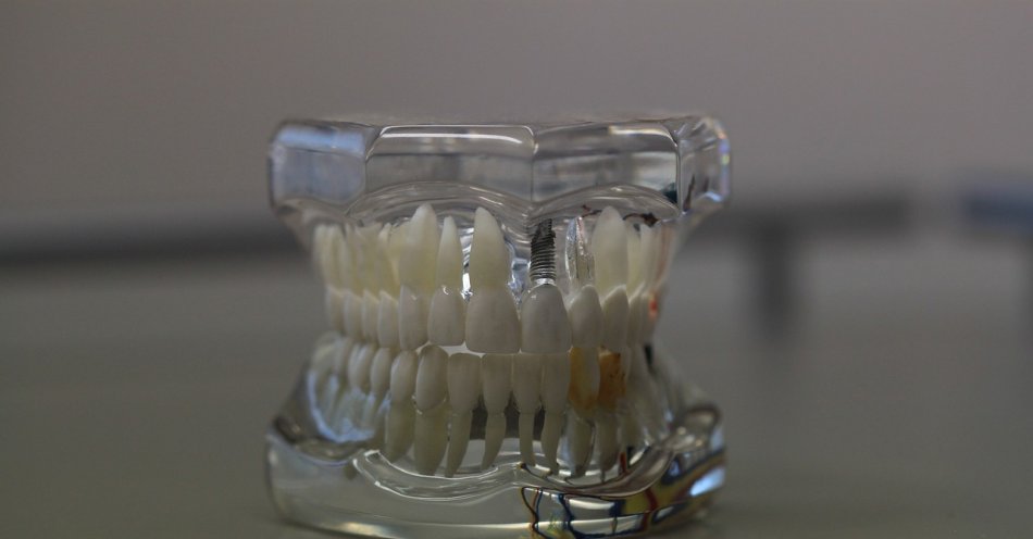 zdjęcie: Naukowcy z Politechniki Wrocławskiej i Tajwanu opracowują nowoczesne dentystyczne implanty / pixabay/668214